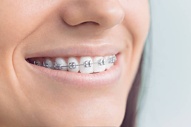 Best Invisalign and Clear Aligners  in Jonesboro, GA